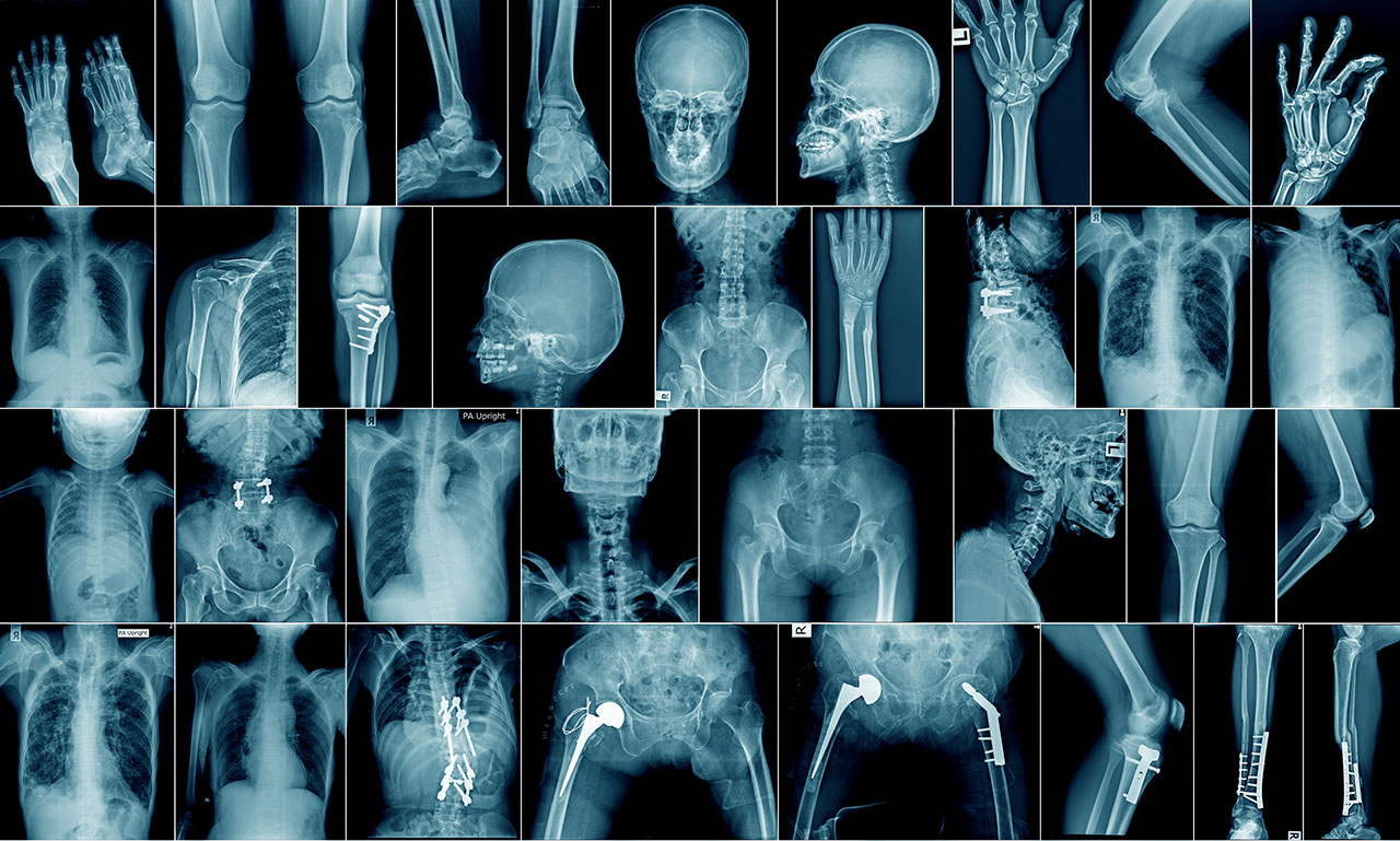 what-s-the-difference-between-mri-and-x-ray-america-s-er